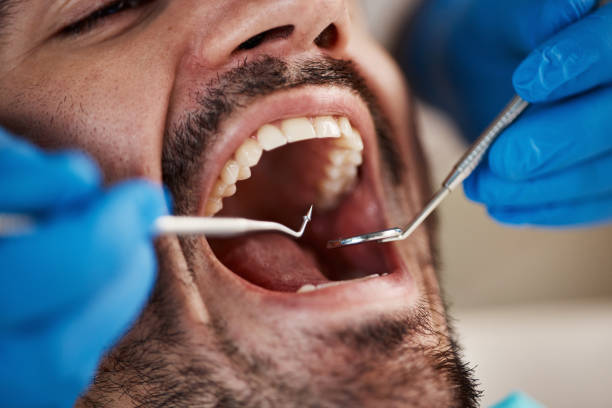 Best Urgent Care for Lost Fillings or Crowns in Anthony, TX